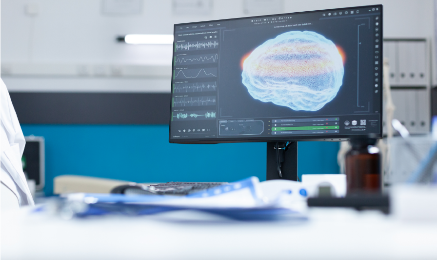 Monitor showing brain data in lab