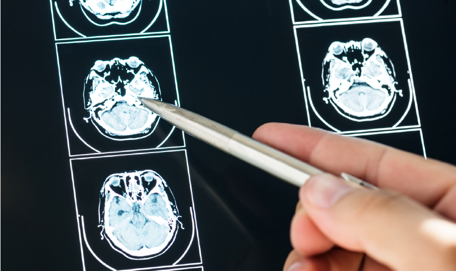 Hand pointing at brain scan images